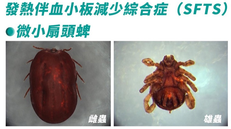 蜱蟲 蜱蟲