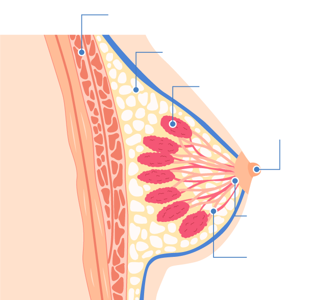 乳癌是什麼？