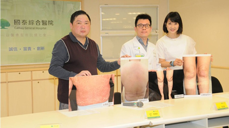 患者吳先生與廖澤源醫師合照 患者吳先生與廖澤源醫師合照