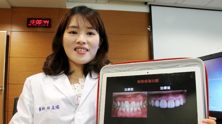 成大醫院口腔醫學部贋復補綴科林孟瑤醫師 成大醫院口腔醫學部贋復補綴科林孟瑤醫師