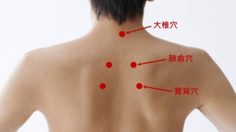 三伏貼的穴位 三伏貼的穴位