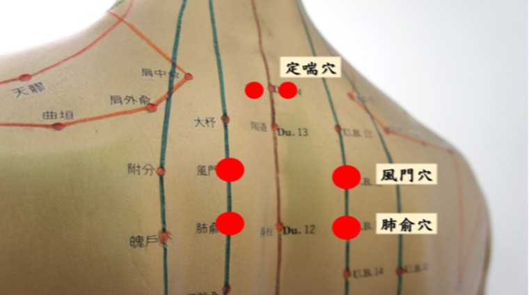 三伏貼穴位 三伏貼穴位