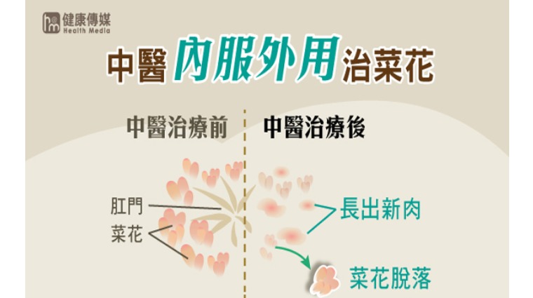 菜花 菜花