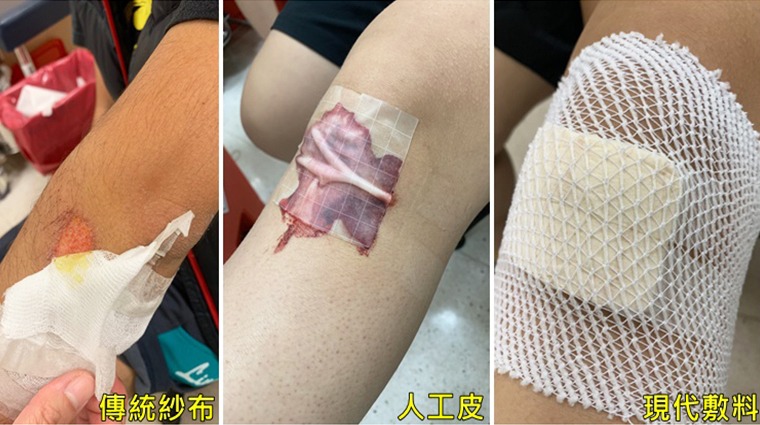敷料比較 敷料比較