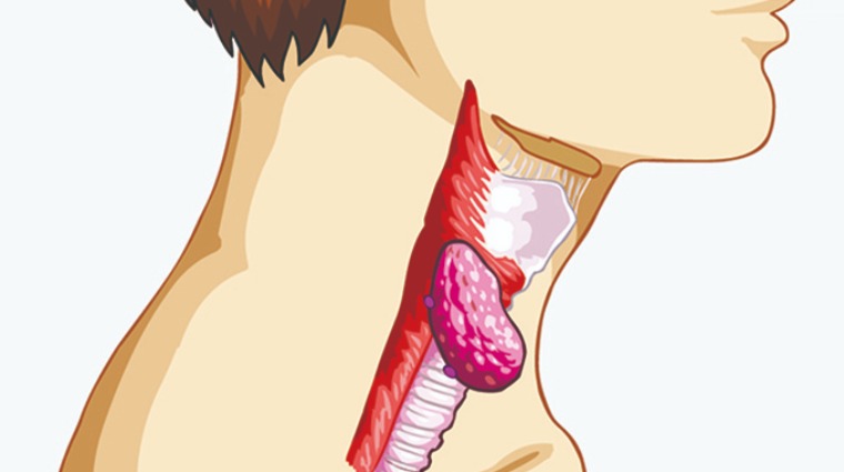 食道癌 食道癌
