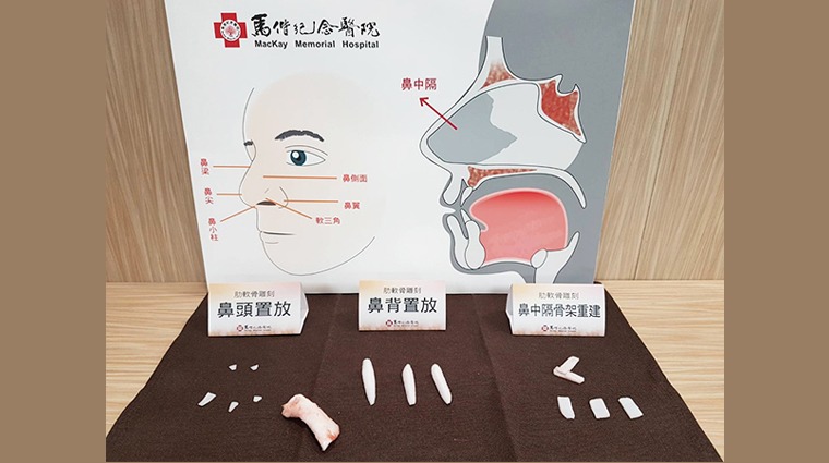 以豬肋骨示意之鼻整形重建素材