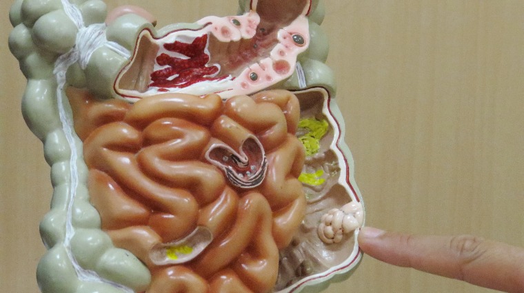 大腸 大腸