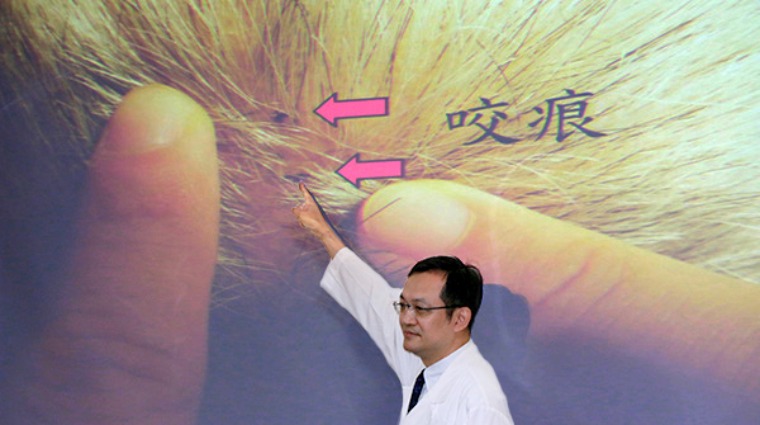 陳燕嘉醫師發表龜殼花咬傷頭部個案