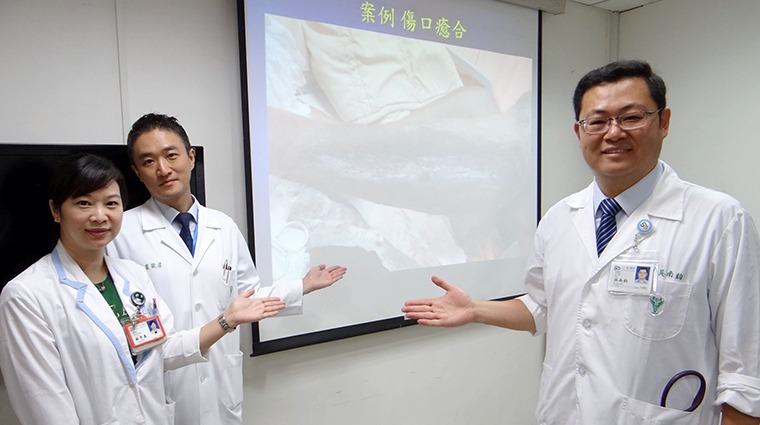 奇美醫學中心外傷科主任吳南鈞(右)、外傷科主治醫師葉敬淳(左2),以及外傷科個管師蘇秀真 奇美醫學中心外傷科主任吳南鈞(右)、外傷科主治醫師葉敬淳(左2),以及外傷科個管師蘇秀真