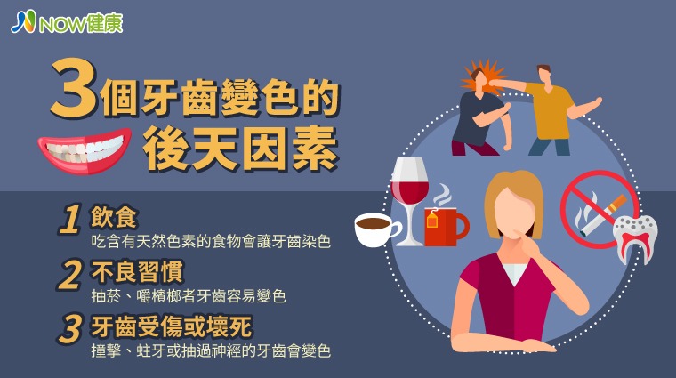 牙齒變色的3個後天因素 牙齒變色的3個後天因素