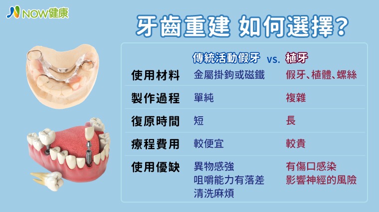 傳統活動假牙與植牙比較