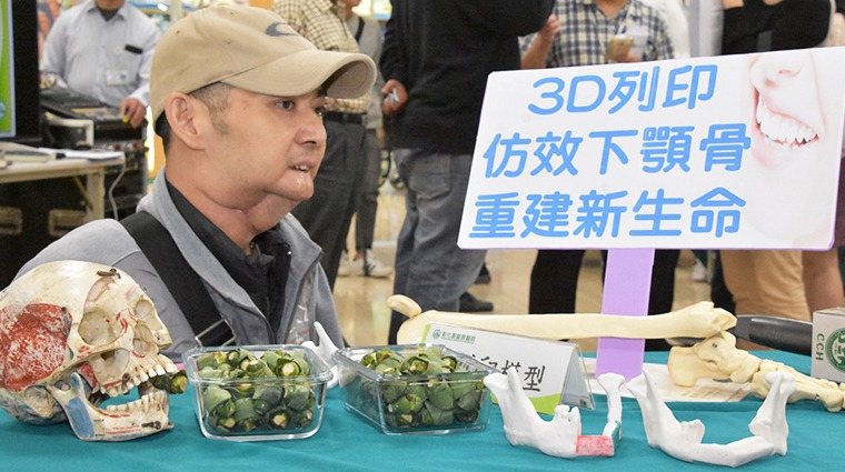 患者何鴻昌 患者何鴻昌