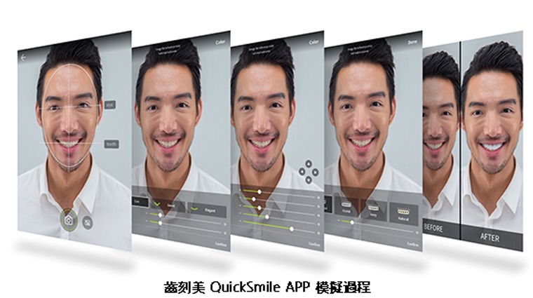 齒刻美 QuickSmile app模擬過程