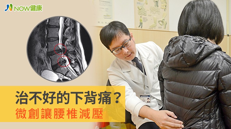 台北慈濟醫院骨科主治醫師李宜軒 台北慈濟醫院骨科主治醫師李宜軒