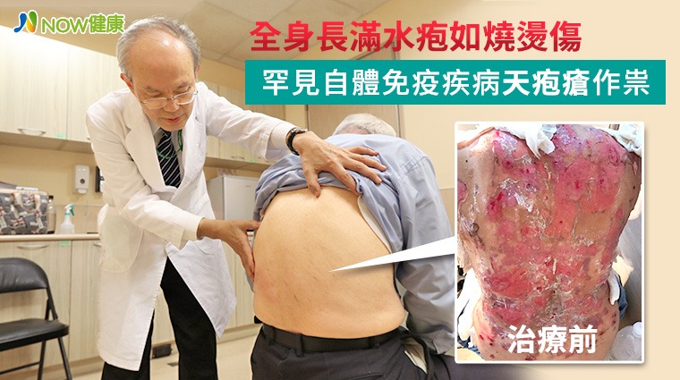 蔡肇基主任替患者檢查患部 蔡肇基主任替患者檢查患部