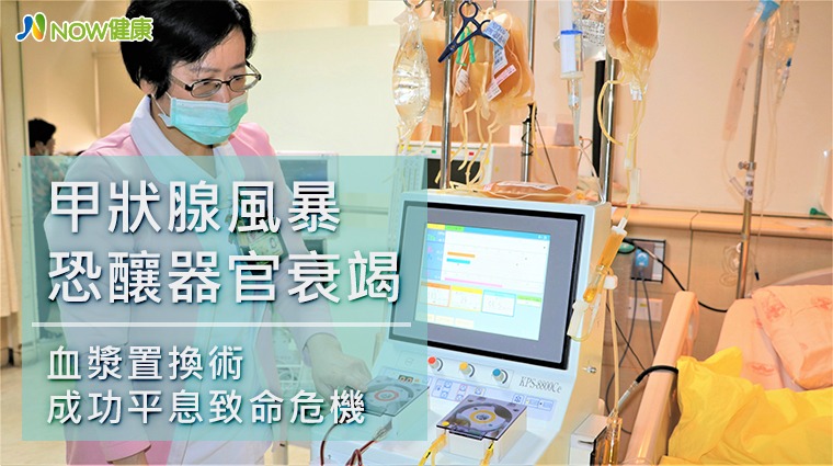 血漿置換機器 血漿置換機器