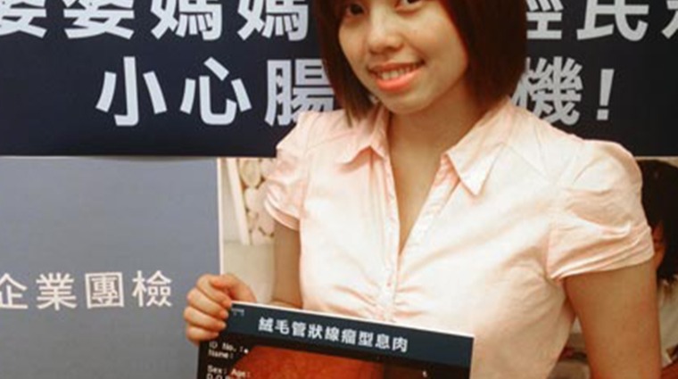 瘜肉 瘜肉
