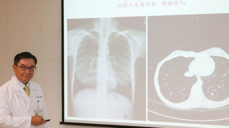 新光醫院健康管理部主任高尚志 新光醫院健康管理部主任高尚志