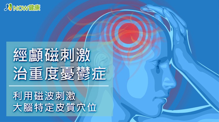 大腦 大腦