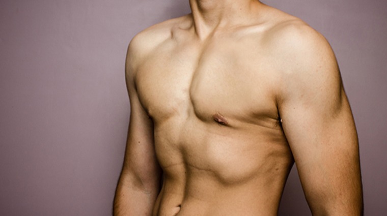 男性胸肌 男性胸肌
