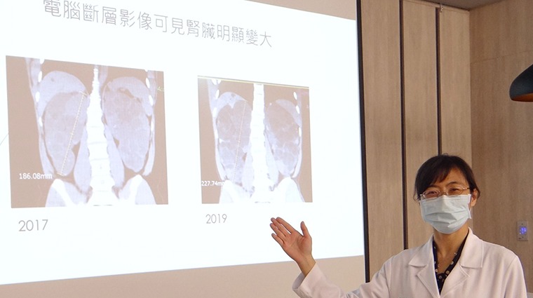 奇美醫學中心腎臟科主治醫師吳佳純 奇美醫學中心腎臟科主治醫師吳佳純