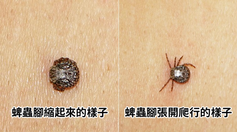 蜱蟲 蜱蟲