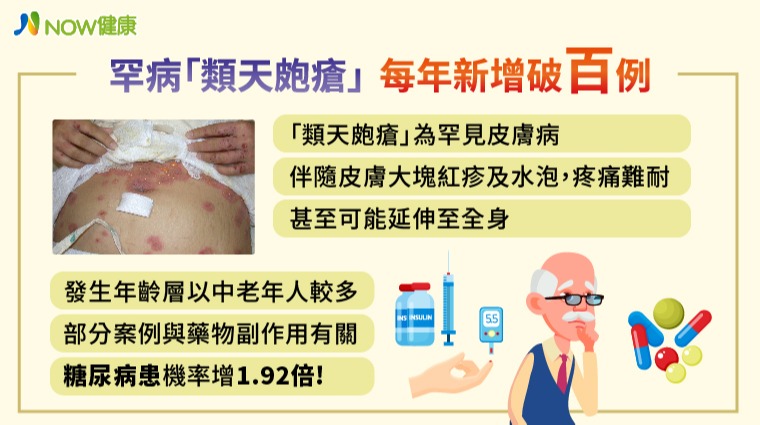 類天皰瘡 類天皰瘡