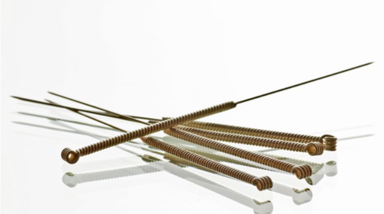 針灸 針灸