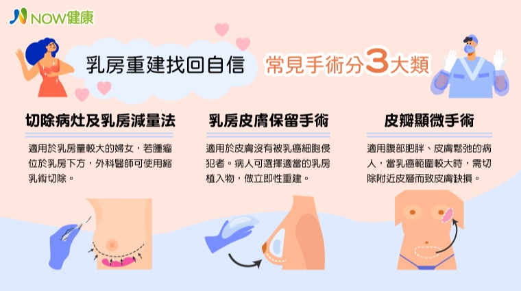 乳房重建 乳房重建