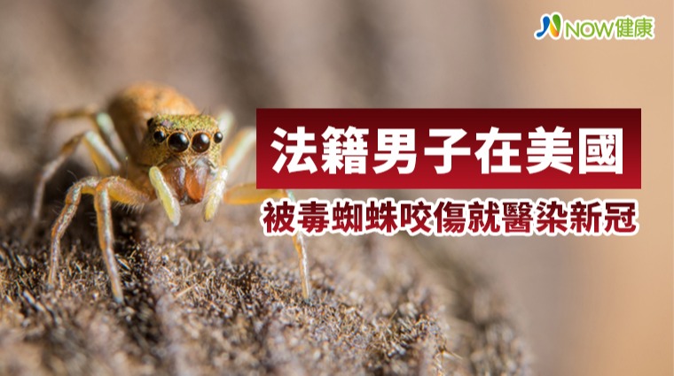 法籍男在美被毒蜘蛛咬傷染新冠 法籍男在美被毒蜘蛛咬傷染新冠