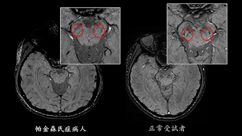 超高梯度磁場磁振造影圖