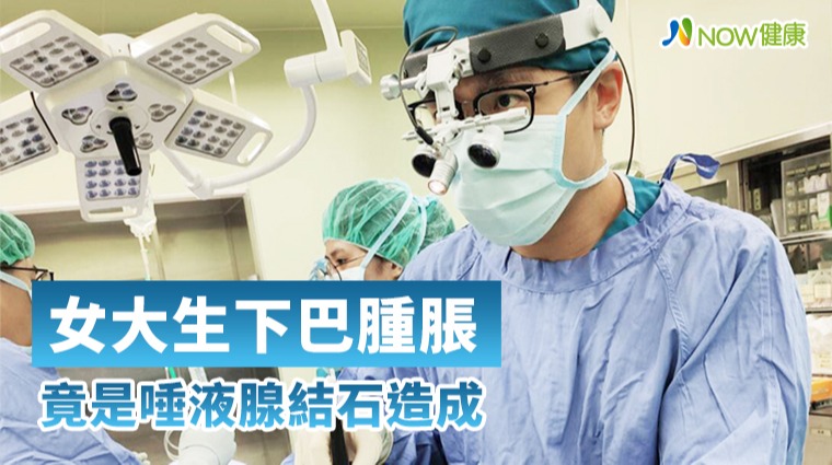 女大生下巴腫脹 竟是唾液腺結石造成 女大生下巴腫脹 竟是唾液腺結石造成