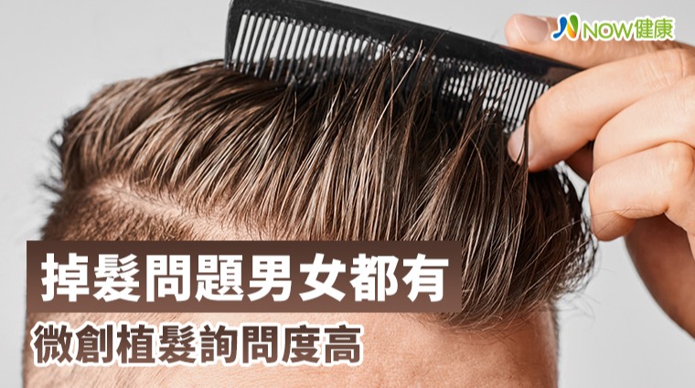 無論男女都會面臨掉髮問題! 無論男女都會面臨掉髮問題!
