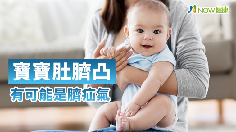 寶寶肚臍凸 有可能是臍疝氣 寶寶肚臍凸 有可能是臍疝氣