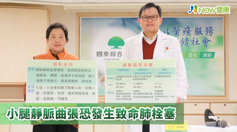 小腿靜脈曲張恐發生致命肺栓塞 小腿靜脈曲張恐發生致命肺栓塞