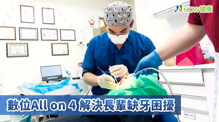 數位All-on-4 解決長輩缺牙困擾 數位All-on-4 解決長輩缺牙困擾