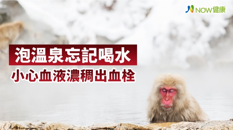 泡溫泉忘記喝水 小心血液濃稠出血栓 泡溫泉忘記喝水 小心血液濃稠出血栓