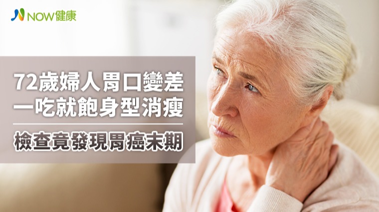 72歲婦人胃口變差一吃就飽身型消瘦檢查竟發現胃癌末期