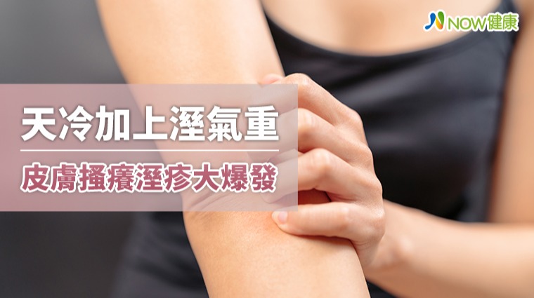 天冷加上溼氣重 皮膚搔癢溼疹大爆發 天冷加上溼氣重 皮膚搔癢溼疹大爆發