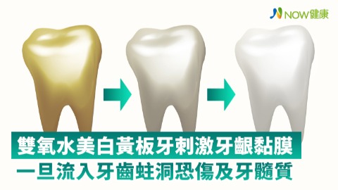 雙氧水美白黃板牙刺激牙齦黏膜 一旦流入牙齒蛀洞恐傷及牙髓質