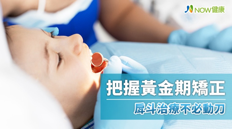 把握黃金期矯正 戽斗治療不必動刀 把握黃金期矯正 戽斗治療不必動刀