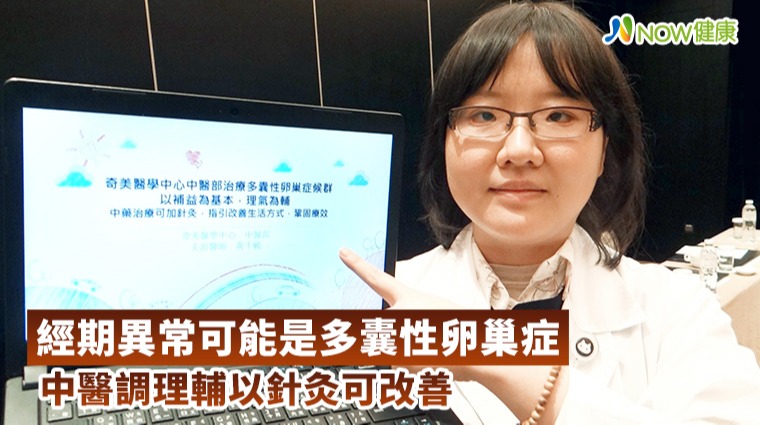 中醫調理多囊性卵巢症 找回月經規律 中醫調理多囊性卵巢症 找回月經規律