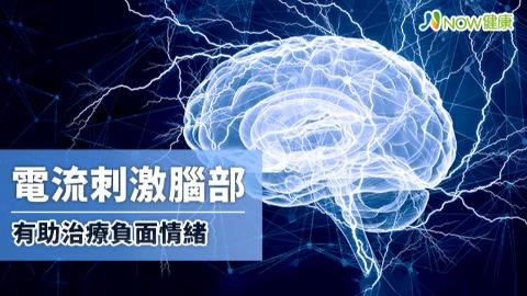 電流刺激腦部 有助治療負面情緒