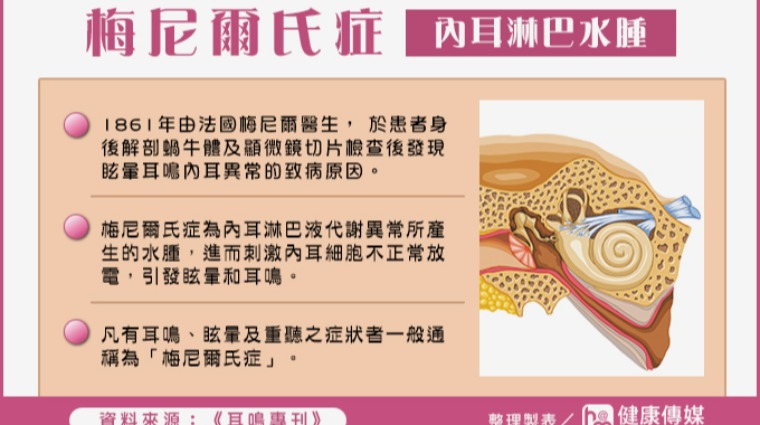 梅尼爾氏症 梅尼爾氏症