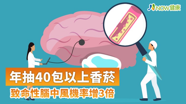 年抽40包以上香菸 致命性腦中風機率增3倍 年抽40包以上香菸 致命性腦中風機率增3倍