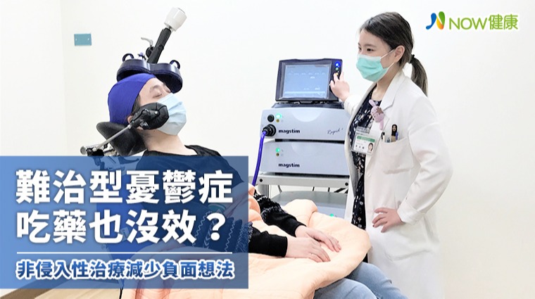 難治型憂鬱症吃藥也沒效? 非侵入性治療減少負面想法 難治型憂鬱症吃藥也沒效? 非侵入性治療減少負面想法
