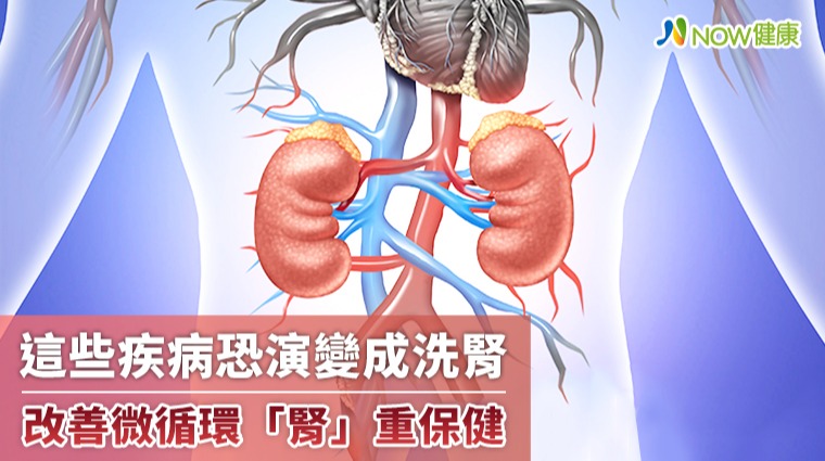 這些疾病恐演變成洗腎 改善體內微循環「腎」重保健 這些疾病恐演變成洗腎 改善體內微循環「腎」重保健