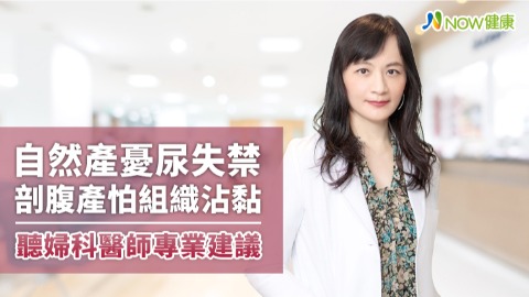 自然產憂尿失禁剖腹產怕組織沾黏 聽婦科醫師專業建議