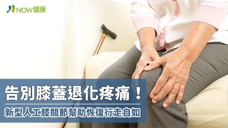 告別膝蓋退化疼痛！ 新型人工膝關節幫助恢復行走自如