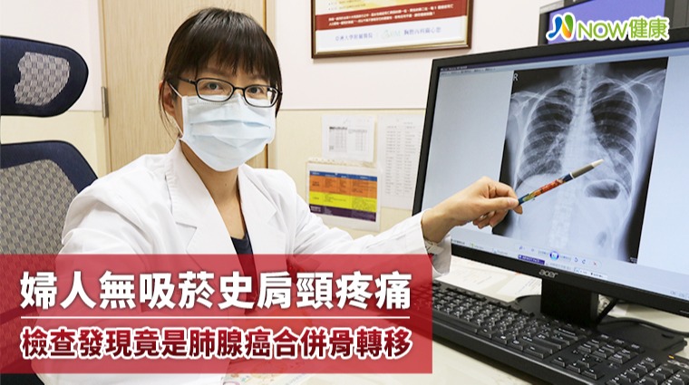 婦人無吸菸史肩頸疼痛 檢查發現竟是肺腺癌合併骨轉移 婦人無吸菸史肩頸疼痛 檢查發現竟是肺腺癌合併骨轉移